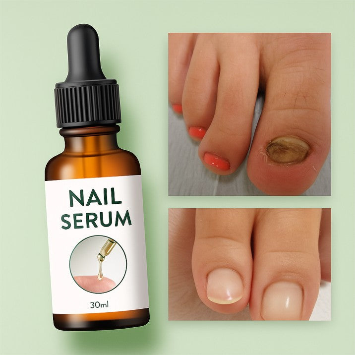 Nail Repair Serum Pack Of 2