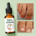 Nail Repair Serum Pack Of 2