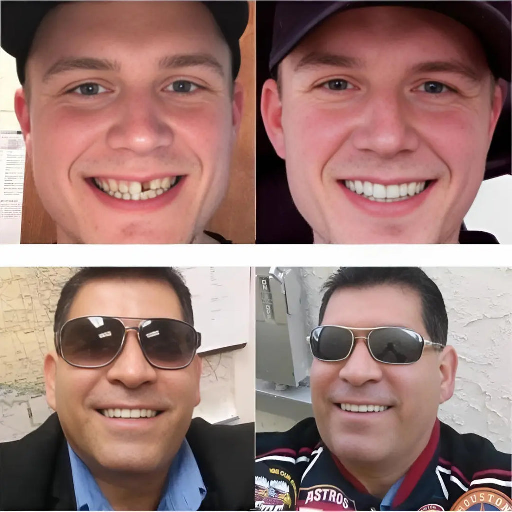 Fit Flex Cosmetic Teeth Denture